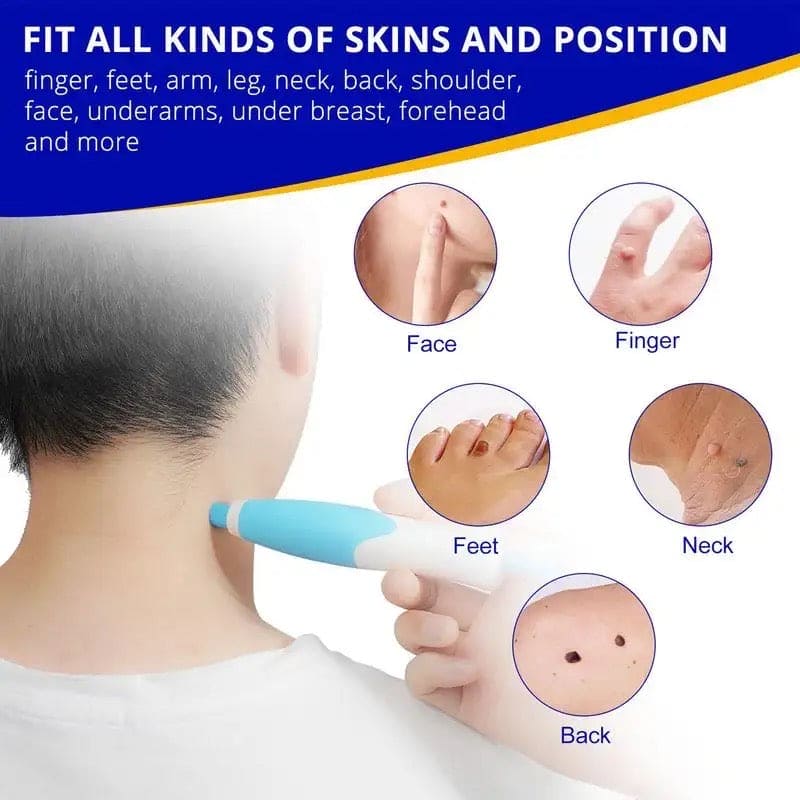 Skin Tag Remover, 2 In1 Painless Auto Skin Tag Remover, Mole Wart Removal Kit, Micro Skin Tag Remover Skin Tag Remover, 2 In1 Painless Auto Skin Tag Remover, Mole Wart Removal Kit, Micro Skin Tag Remover
